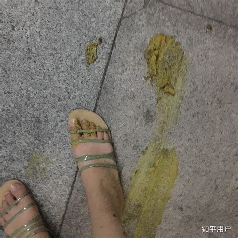 踩到屎怎麼清|[問題] 崩潰～踩到大便的清理....